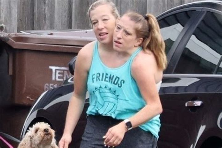 Unveiling The Extraordinary Journey Of Abby And Brittany Hensel