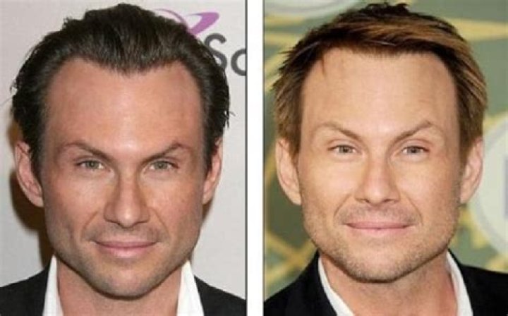 Unveiling The Truth Behind Christian Slater's Plastic Surgery Journey: Discoveries And Revelations