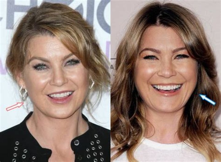 Ellen Pompeo's Plastic Surgery Journey