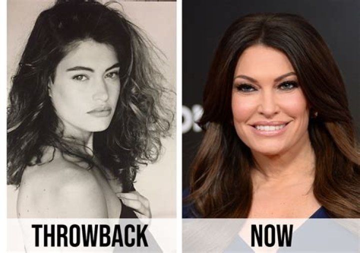 Unveiling Kimberly Guilfoyle's Transformation: Before The Surgeon's Touch