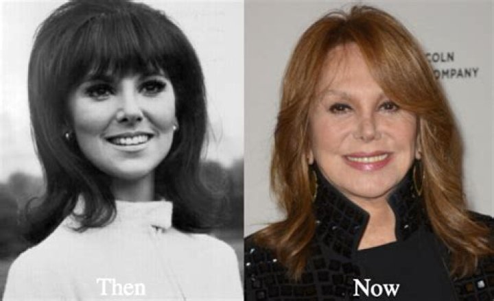 Unveiling The Marlo Thomas Facelift: Discoveries And Insights