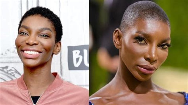 Michaela Coel Before Plastic Surgery