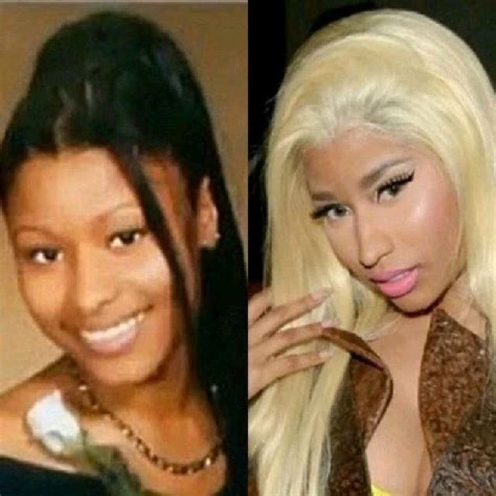 Nicki Minaj's Skin Bleaching Journey And Its Impact