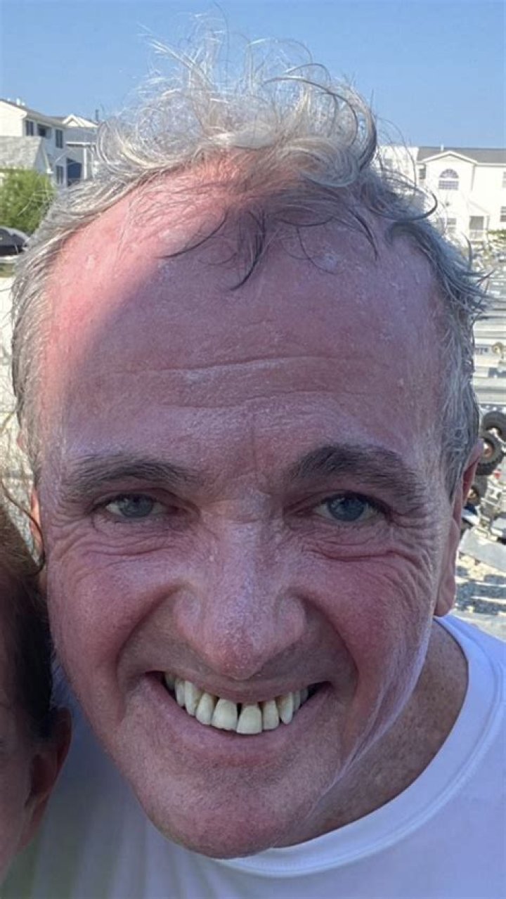 Uncover The Secrets Behind Phil Murphy's Teeth: A Dental Deep Dive