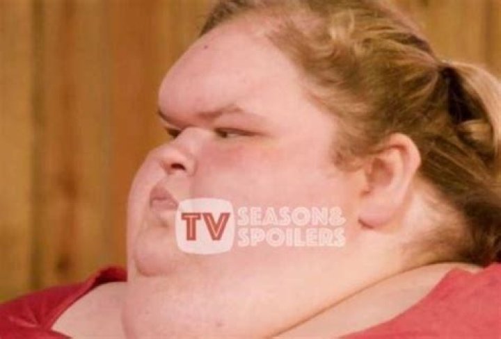 Discover The Hidden Truths And Myths Behind The "Tammy Forehead"