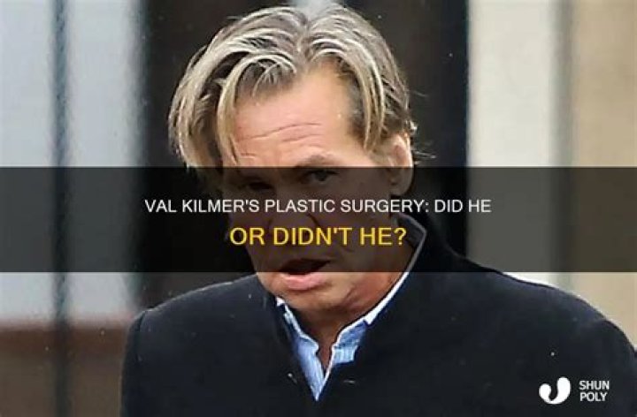 Unveiling The Truth Behind Val Kilmer's Remarkable Transformation