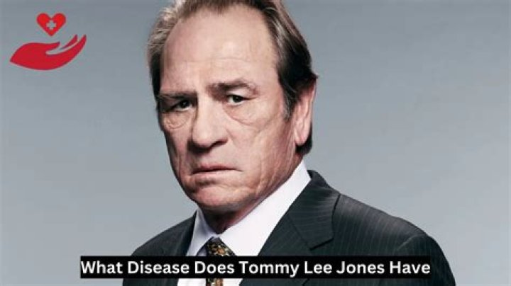 Tommy Lee Jones's Neurological Journey